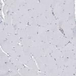 USP11 Antibody in Immunohistochemistry (Paraffin) (IHC (P))