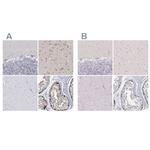 USP11 Antibody in Immunohistochemistry (IHC)