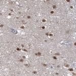 USP11 Antibody in Immunohistochemistry (IHC)