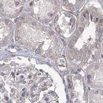 USP11 Antibody in Immunohistochemistry (IHC)