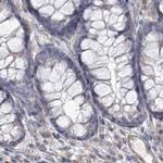 USP11 Antibody in Immunohistochemistry (IHC)