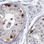 USP11 Antibody in Immunohistochemistry (IHC)