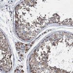 SPAG16 Antibody in Immunohistochemistry (Paraffin) (IHC (P))