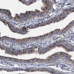 SPAG16 Antibody in Immunohistochemistry (Paraffin) (IHC (P))