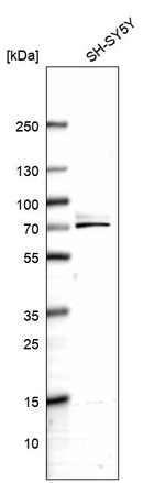 SPAG16 Antibody in Western Blot (WB)
