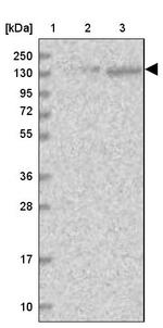 SR140 Antibody in Western Blot (WB)
