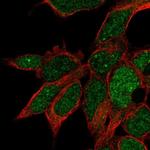 RPUSD3 Polyclonal Antibody