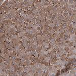 RPUSD3 Antibody in Immunohistochemistry (Paraffin) (IHC (P))