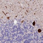 RPUSD3 Polyclonal Antibody