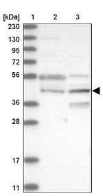 RPUSD3 Antibody in Western Blot (WB)