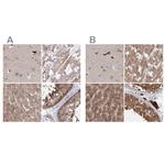 MKRN2 Antibody in Immunohistochemistry (IHC)
