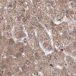 MKRN2 Antibody in Immunohistochemistry (IHC)