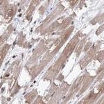 MKRN2 Antibody in Immunohistochemistry (IHC)