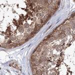 MKRN2 Antibody in Immunohistochemistry (IHC)