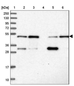MKRN2 Antibody in Western Blot (WB)