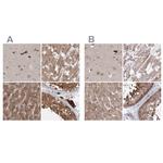 MKRN2 Antibody in Immunohistochemistry (IHC)