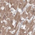 MKRN2 Antibody in Immunohistochemistry (IHC)