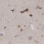 MKRN2 Antibody in Immunohistochemistry (IHC)