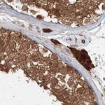 MKRN2 Antibody in Immunohistochemistry (IHC)