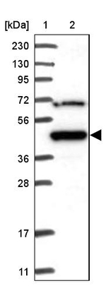 MKRN2 Antibody in Western Blot (WB)