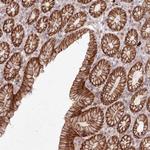 FAM179A Polyclonal Antibody