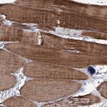 EPB41L5 Antibody in Immunohistochemistry (IHC)