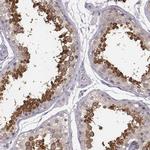 SPA17 Antibody in Immunohistochemistry (IHC)