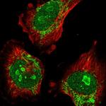 ATAD1 Polyclonal Antibody