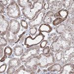 ATAD1 Antibody in Immunohistochemistry (Paraffin) (IHC (P))