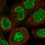 CCDC34 Polyclonal Antibody