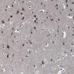 CCDC34 Antibody in Immunohistochemistry (Paraffin) (IHC (P))
