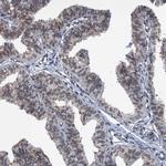 CCDC34 Antibody in Immunohistochemistry (Paraffin) (IHC (P))