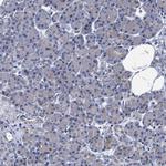 CCDC34 Antibody in Immunohistochemistry (Paraffin) (IHC (P))