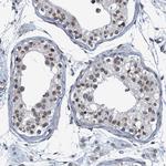 CCDC34 Antibody in Immunohistochemistry (Paraffin) (IHC (P))