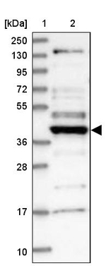 CCDC34 Antibody in Western Blot (WB)