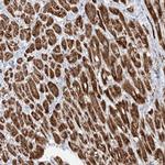 CRY2 Antibody in Immunohistochemistry (Paraffin) (IHC (P))
