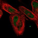 FAM168A Polyclonal Antibody