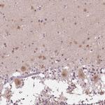FAM168A Antibody in Immunohistochemistry (IHC)