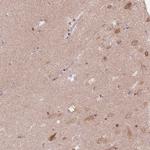 FAM168A Antibody in Immunohistochemistry (IHC)