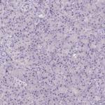 FAM168A Antibody in Immunohistochemistry (IHC)