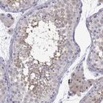 TTC18 Polyclonal Antibody