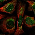 THNSL1 Antibody in Immunocytochemistry (ICC/IF)