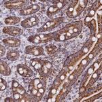 C1D Polyclonal Antibody