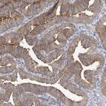 FAM175B Antibody in Immunohistochemistry (Paraffin) (IHC (P))