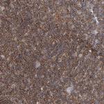 FAM175B Antibody in Immunohistochemistry (Paraffin) (IHC (P))