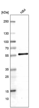 FAM175B Antibody in Western Blot (WB)