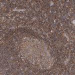 FAM175B Antibody in Immunohistochemistry (IHC)
