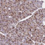 FAM175B Polyclonal Antibody