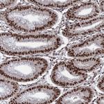 PRPF18 Polyclonal Antibody