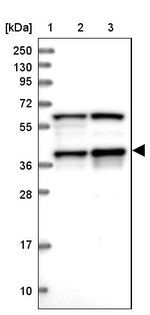 PRPF18 Antibody in Western Blot (WB)